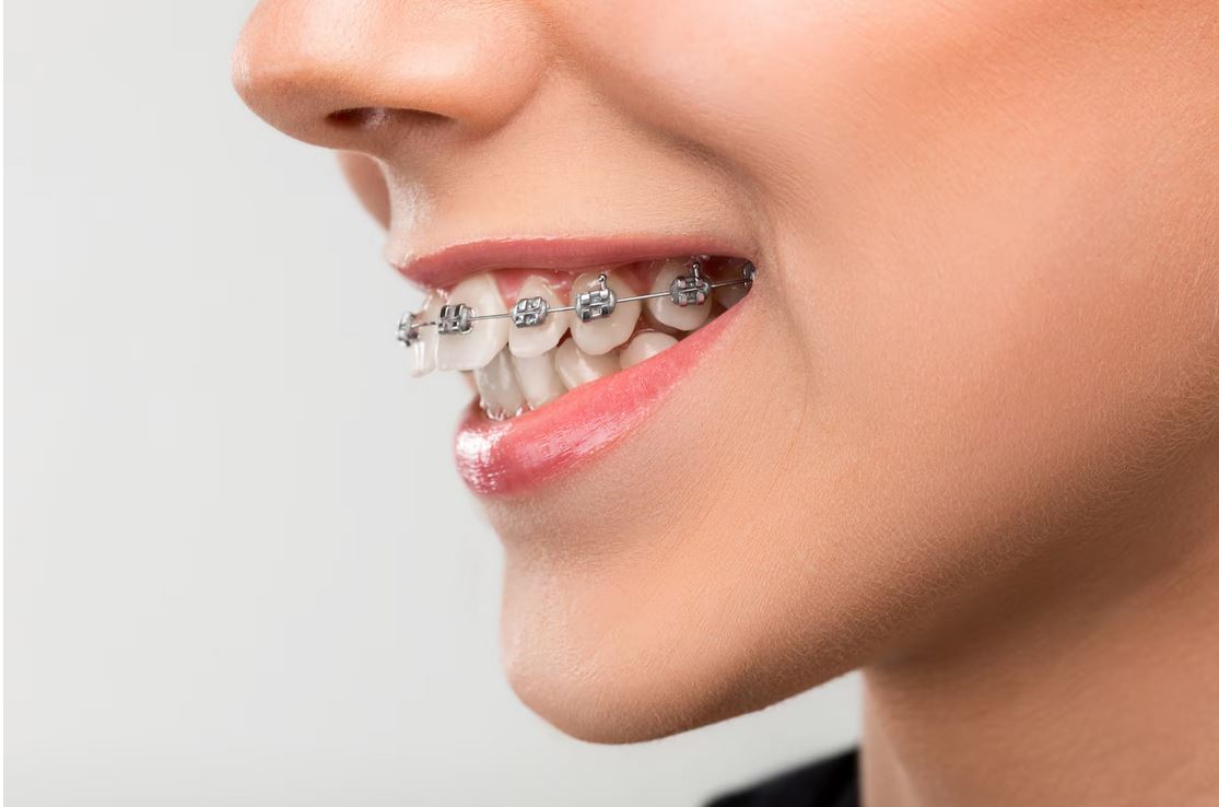 Beyond Straight Teeth: The Full Spectrum of Orthodontic Care